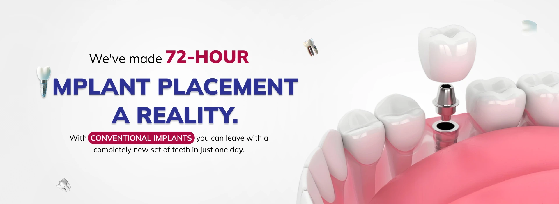 Dental Implants (4)